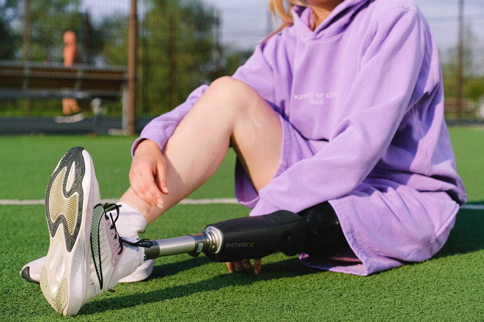 Ragazza in pantaloncini corti siede sull'erba e mostra la protesi della gamba artificiale